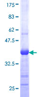 12.5% SDS-PAGE Stained with Coomassie Blue.